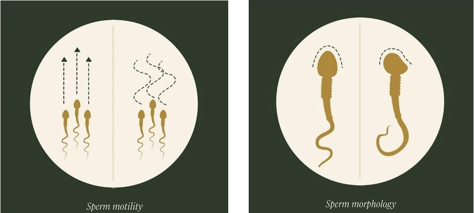 sperm mobility